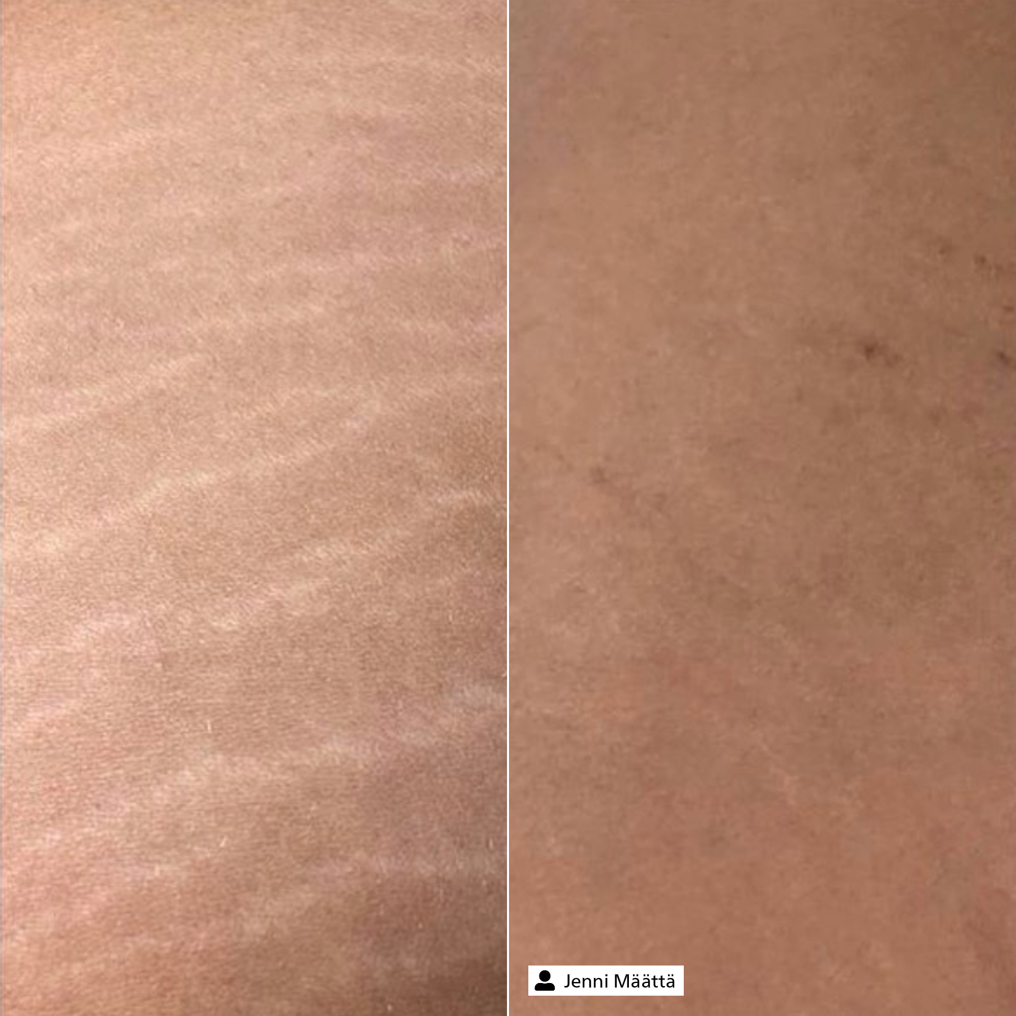 Tissue Firming Serum