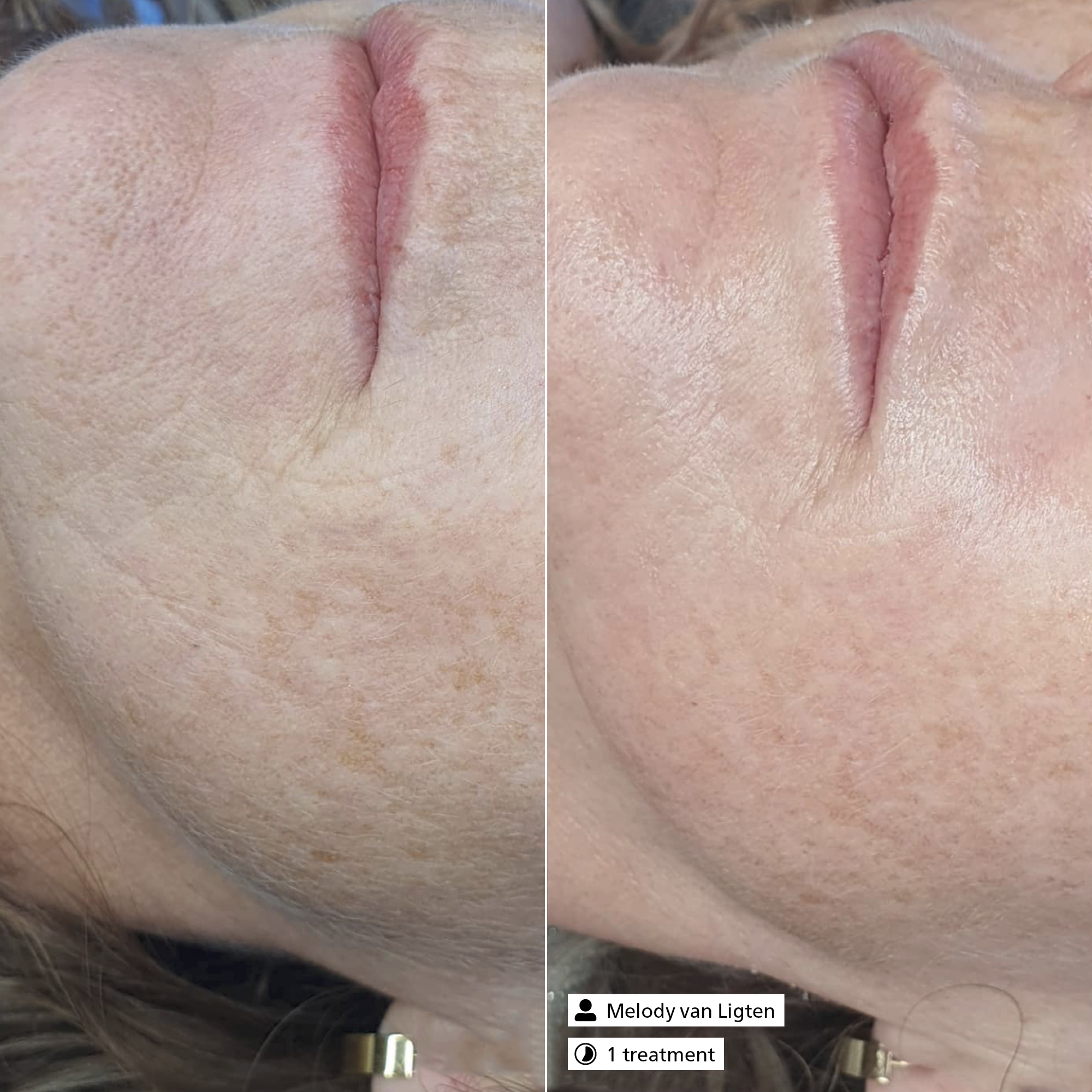 Anti-Aging Serum