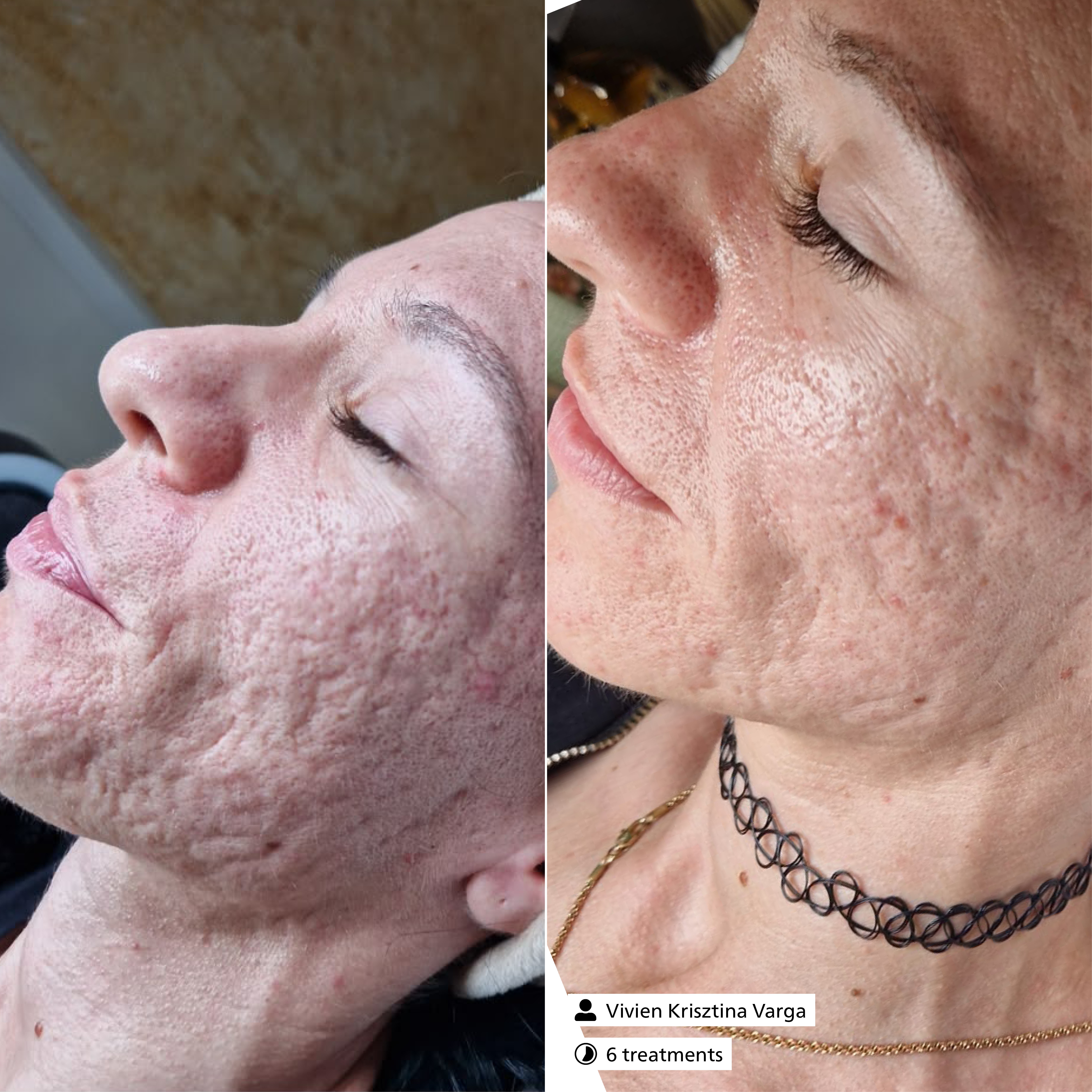 Scar Relaxing Serum