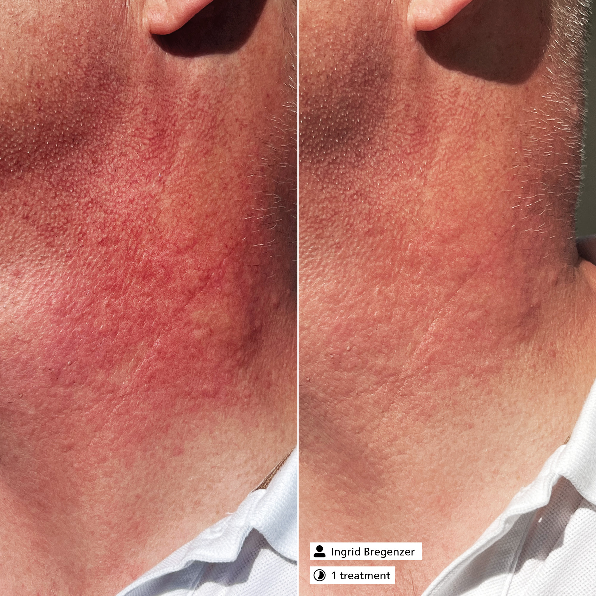 Active Exosome Serum Active Exosome Serum