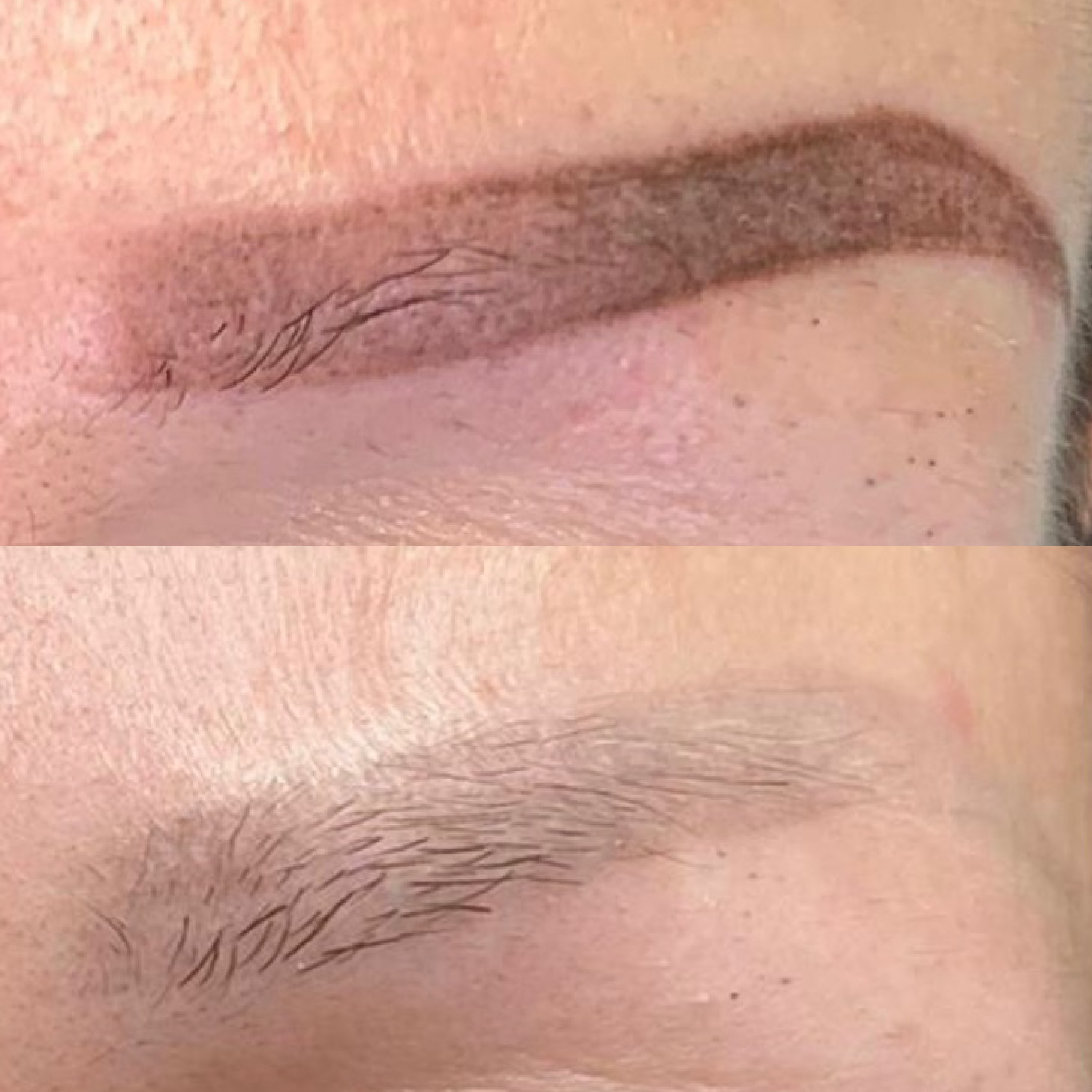 ingrid_bregenzer_removal_1