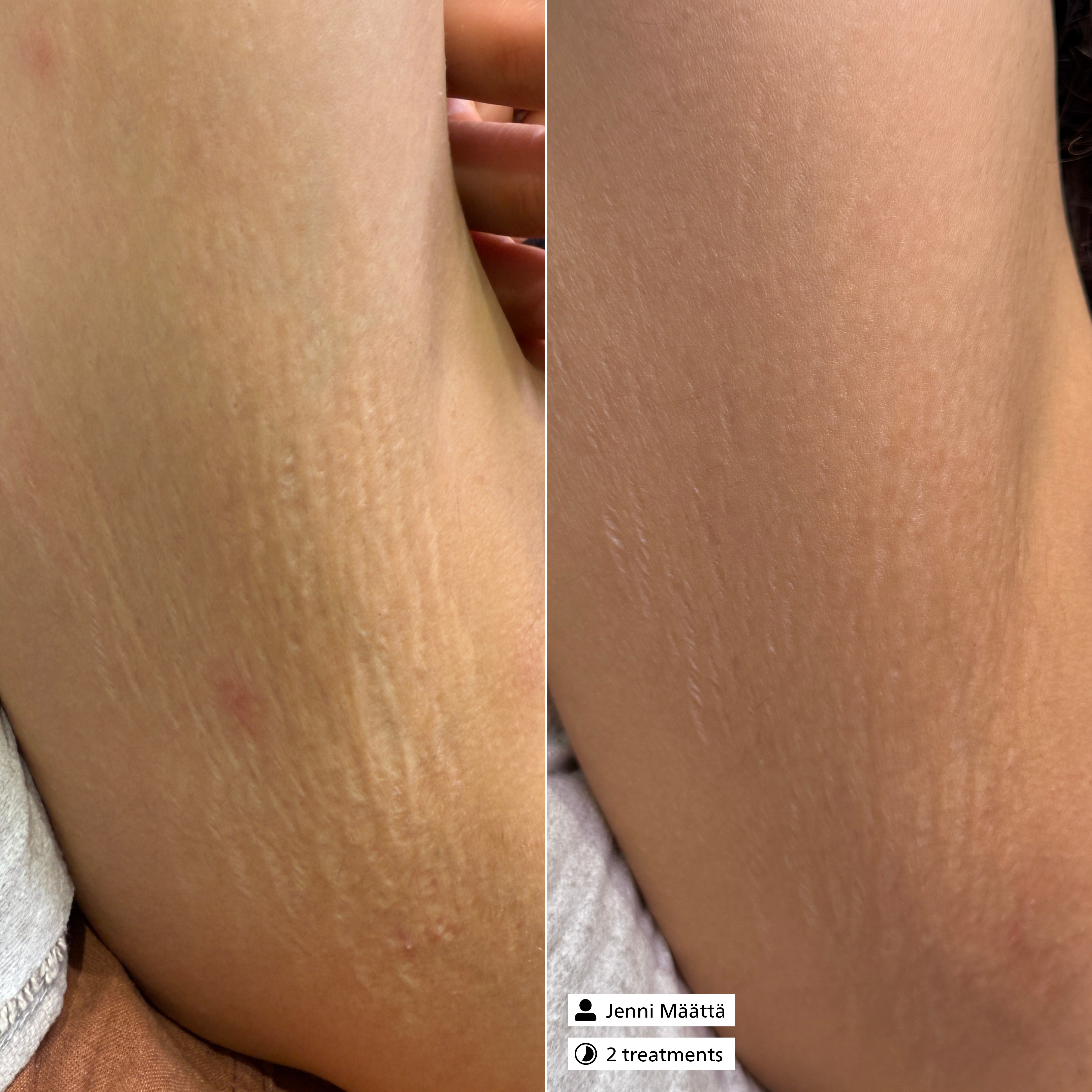 Active Exosome Serum Active Exosome Serum