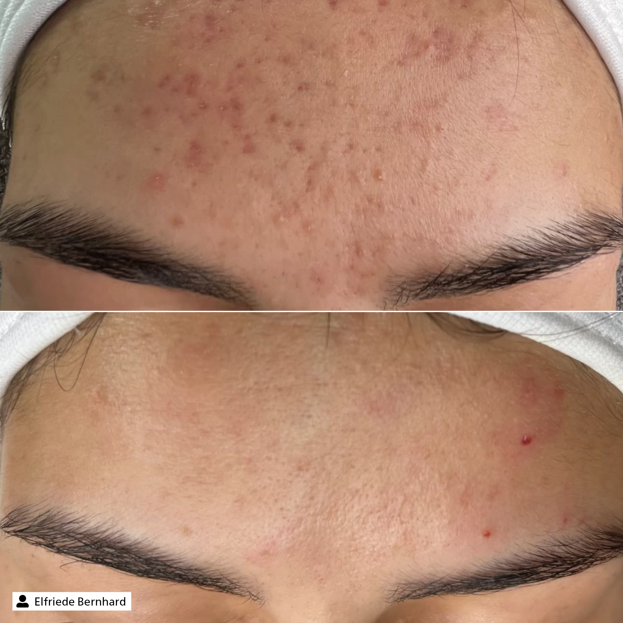 Blemish Control Essence - Travel Size Blemish Control Essence - Travel Size