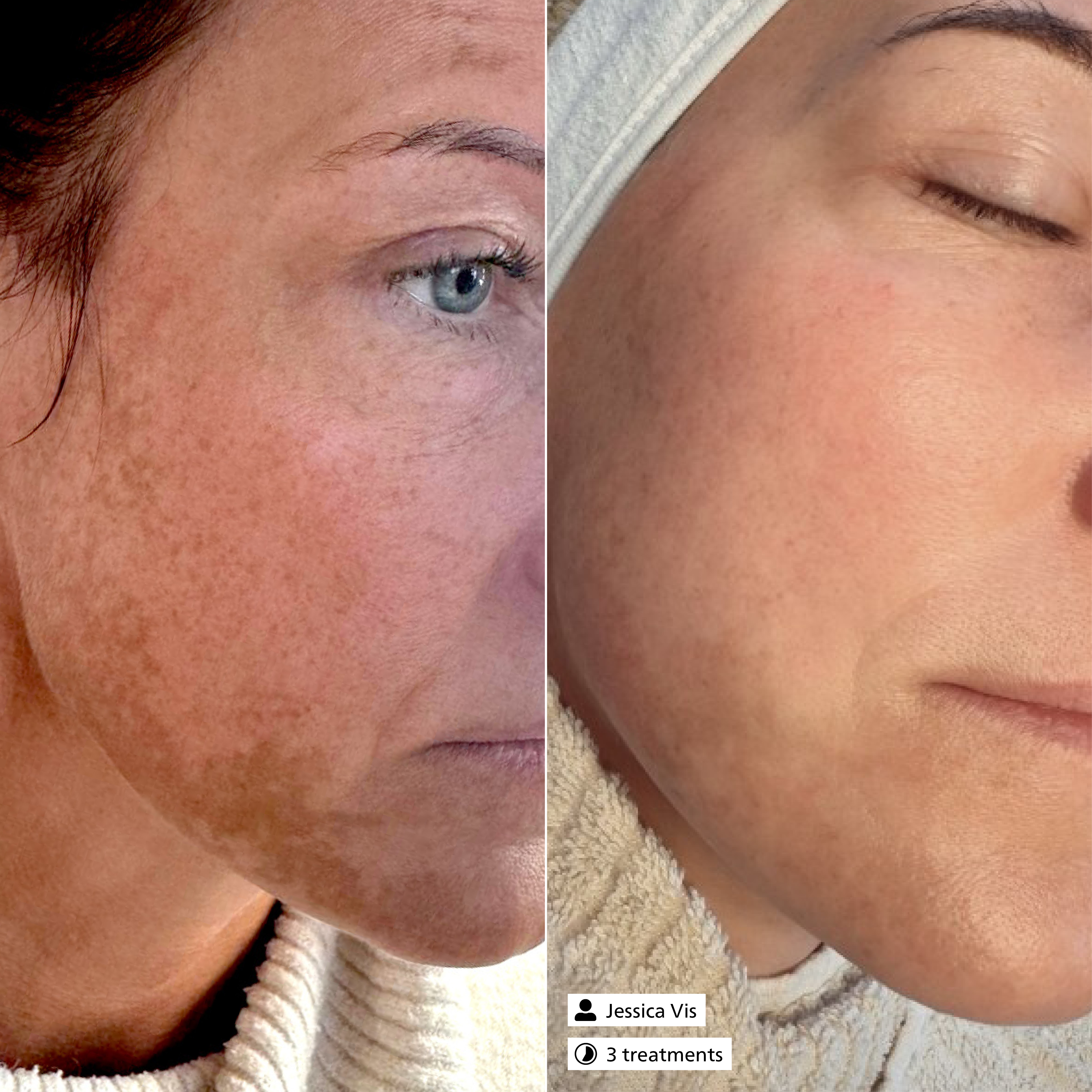 Pure Vitamin C Serum