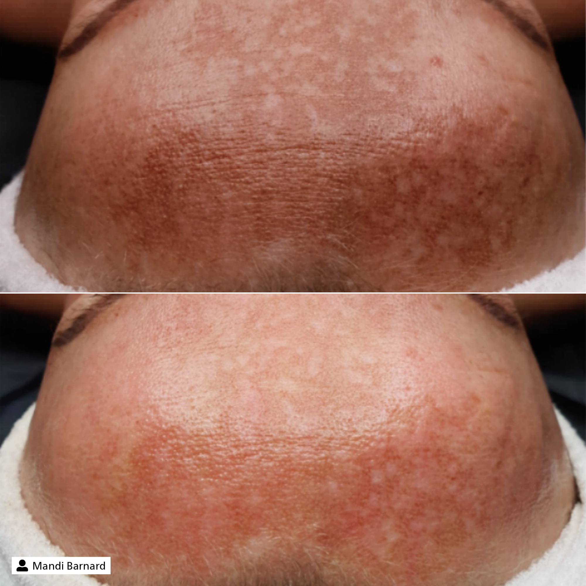 Vitamin C Repair Fluid Vitamin C Repair Fluid