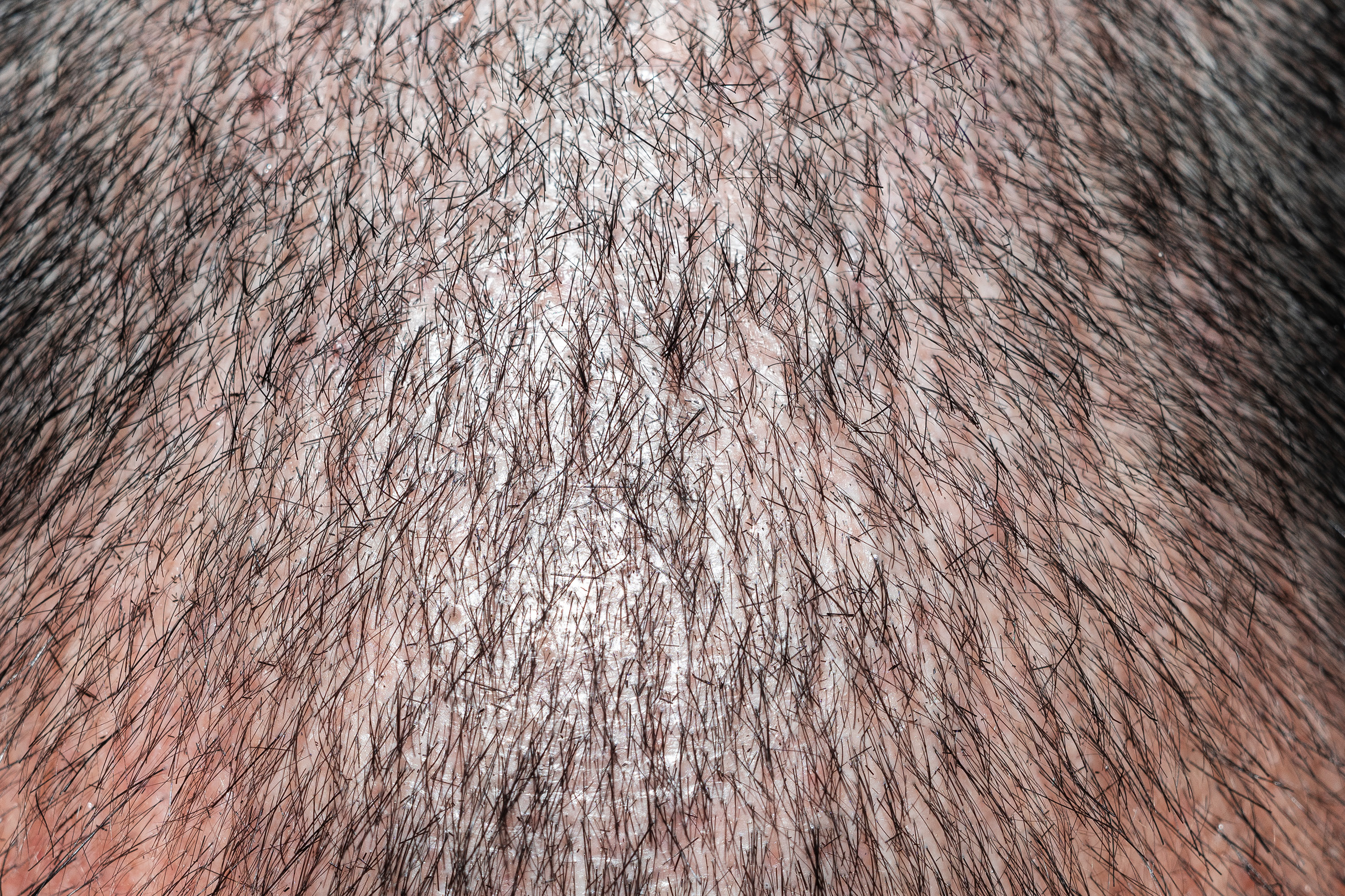 dsr_category_hair_vitality_1