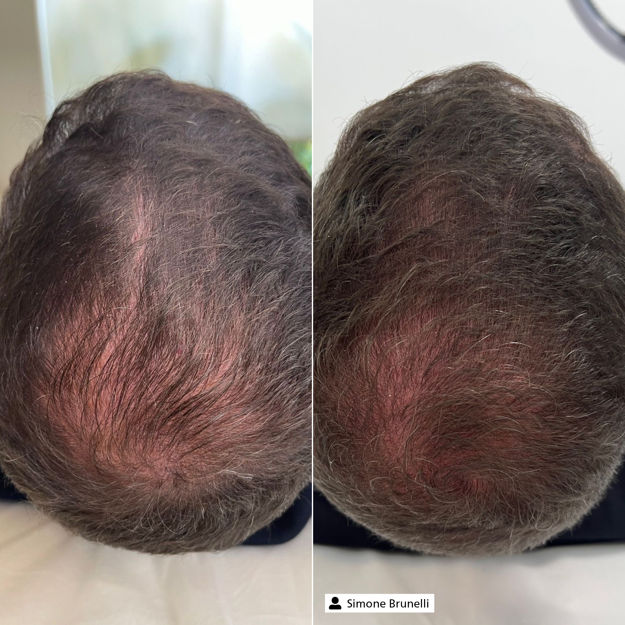 Hair Vitalizer Complex Hair Vitalizer Complex