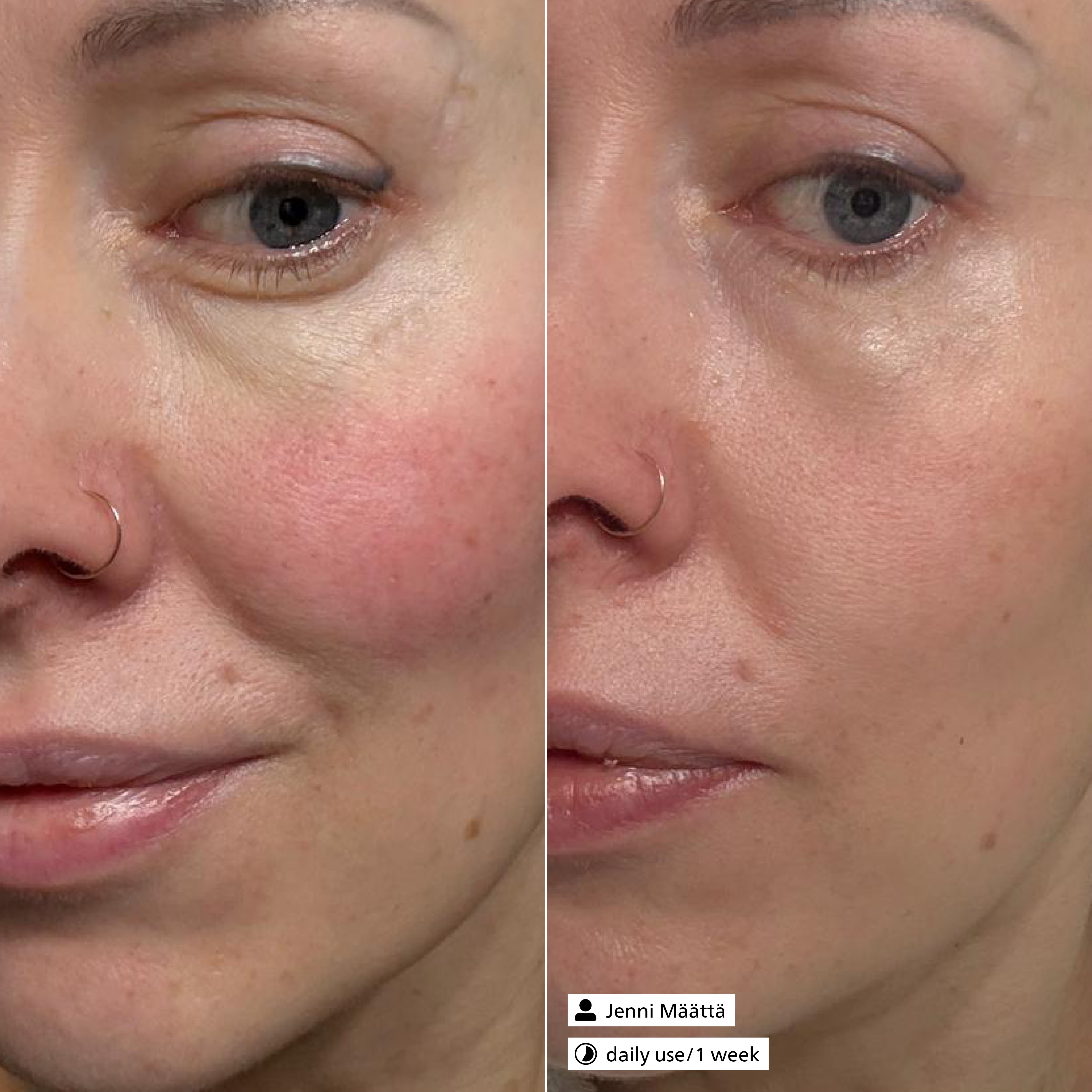 Couperose Control Essence