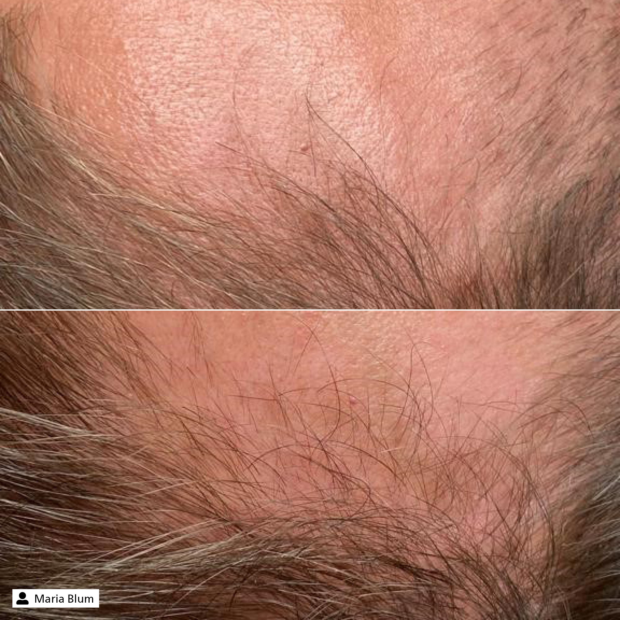 Hair Vitalizer Serum Hair Vitalizer Serum