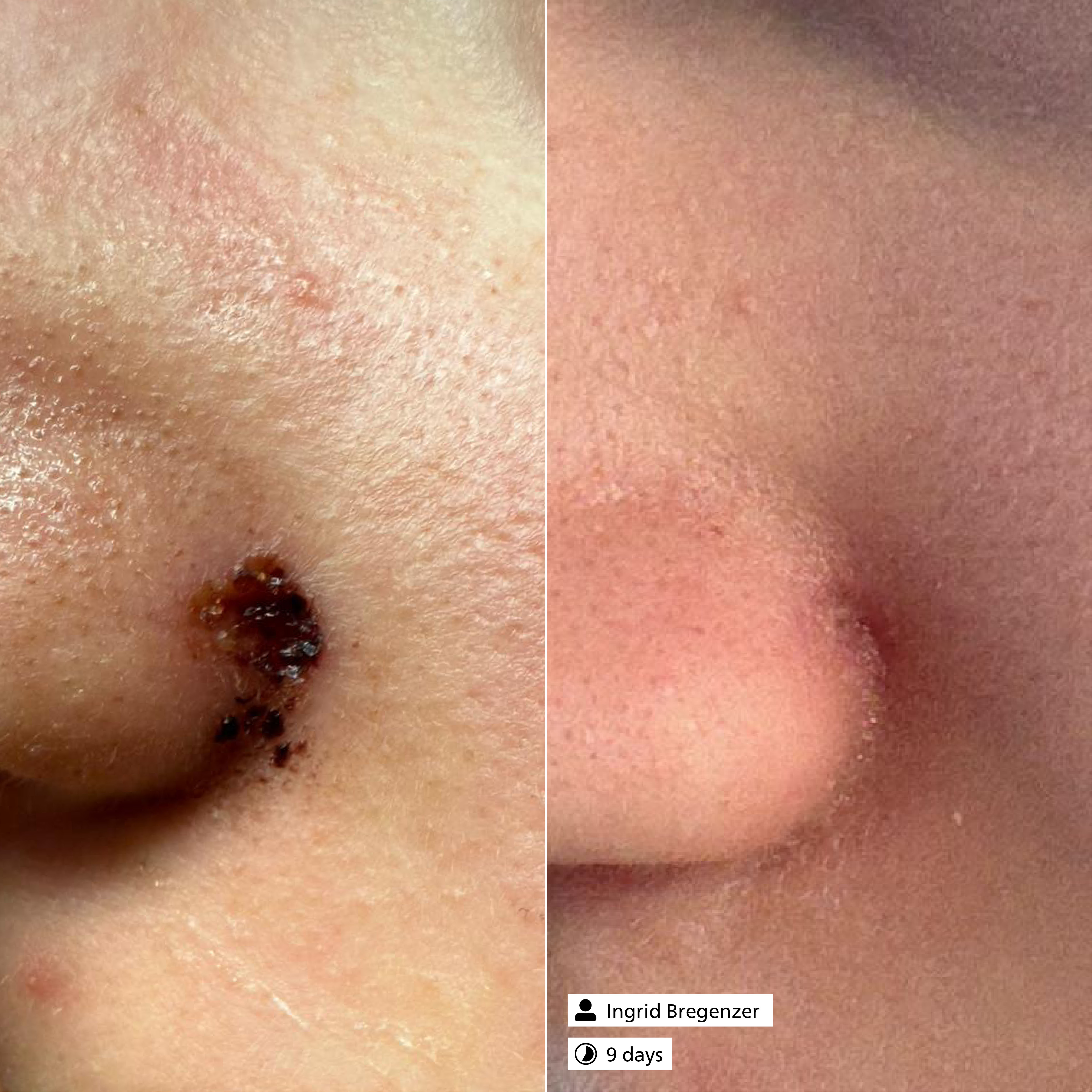 Active Exosome Serum