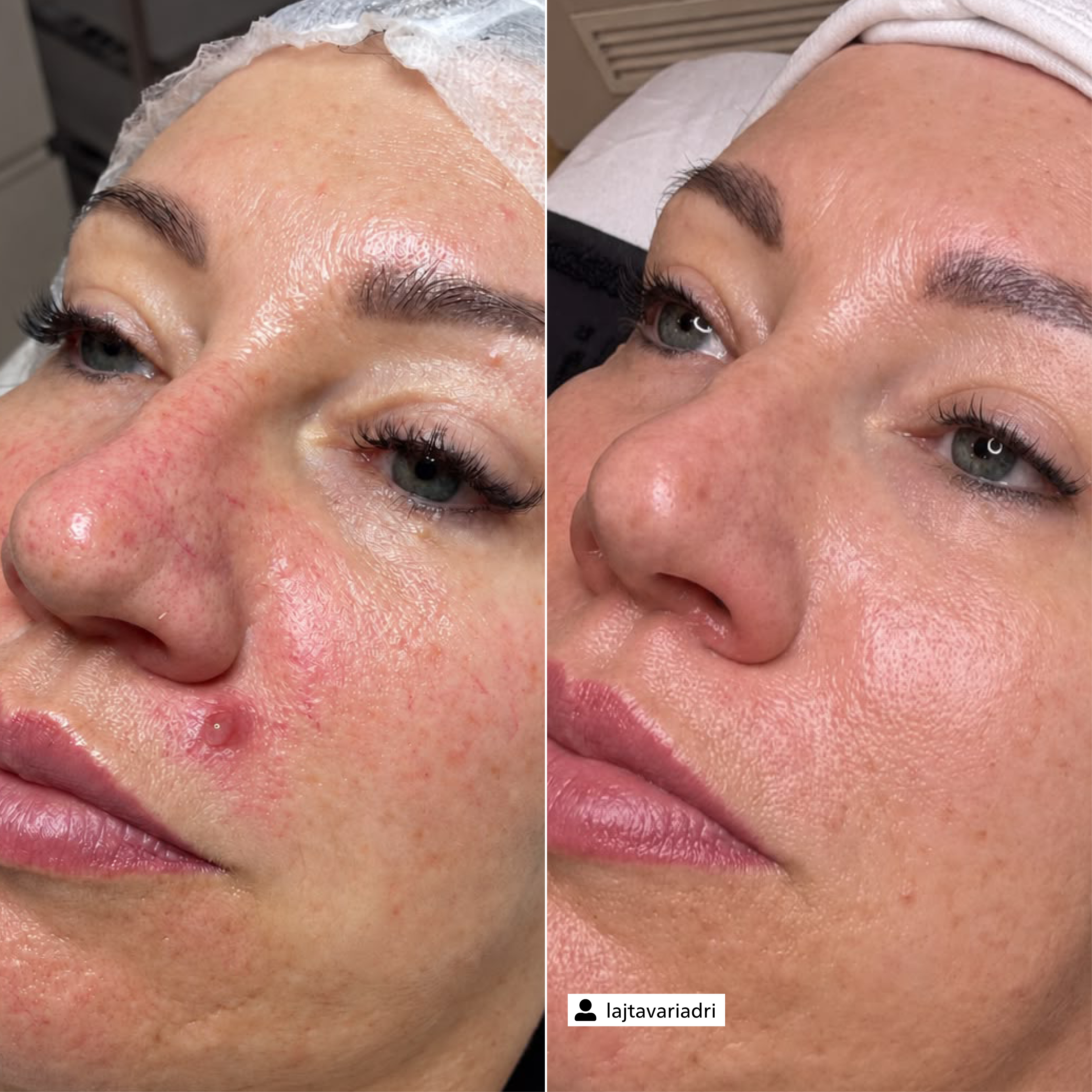 Couperose Control Essence
