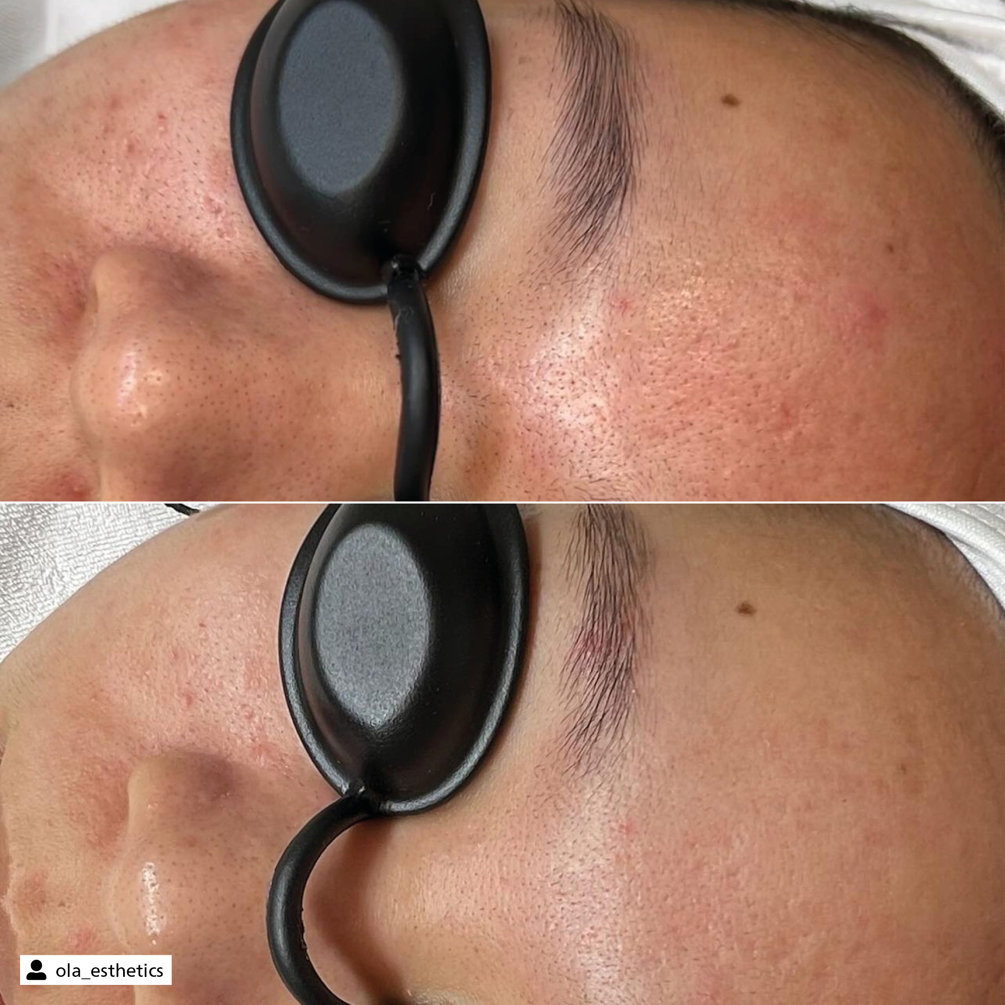Deep Pore Cleansing Peel off Mask