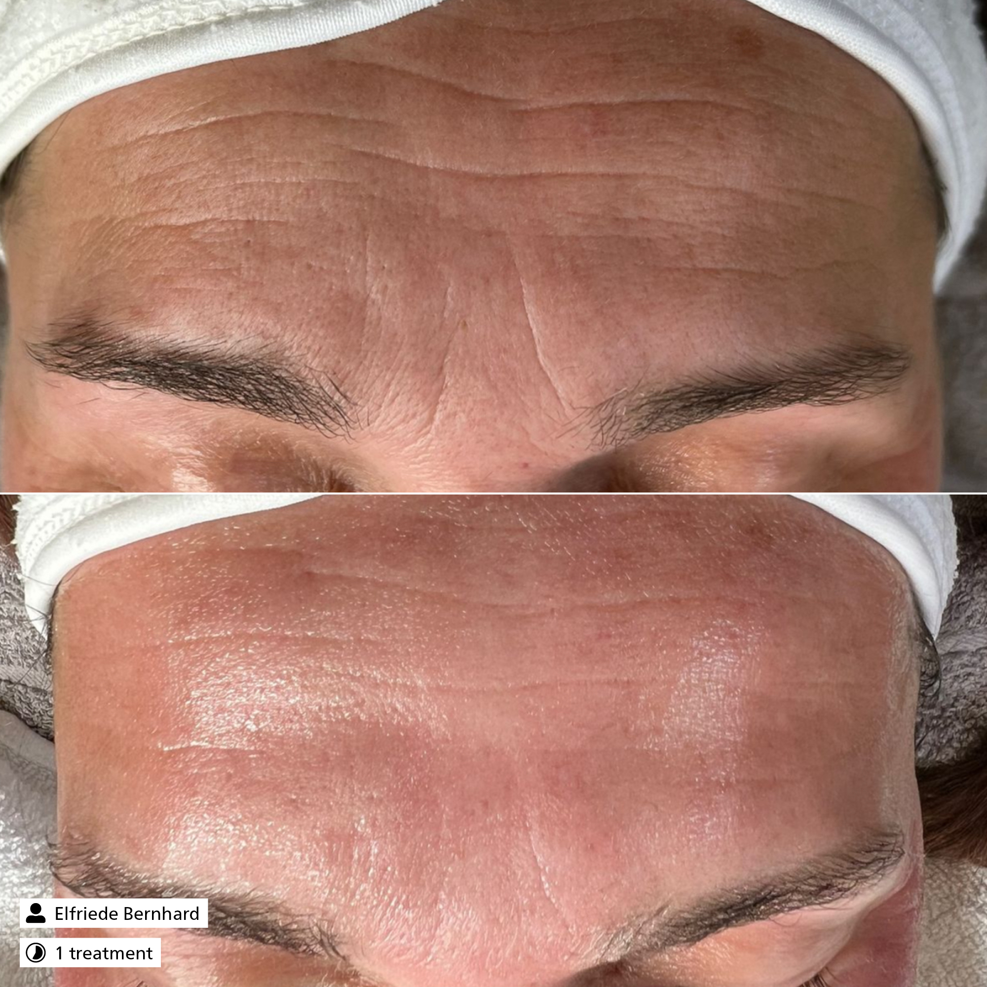 Glycolic Exfoliator 20% Glycolic Exfoliator 20%