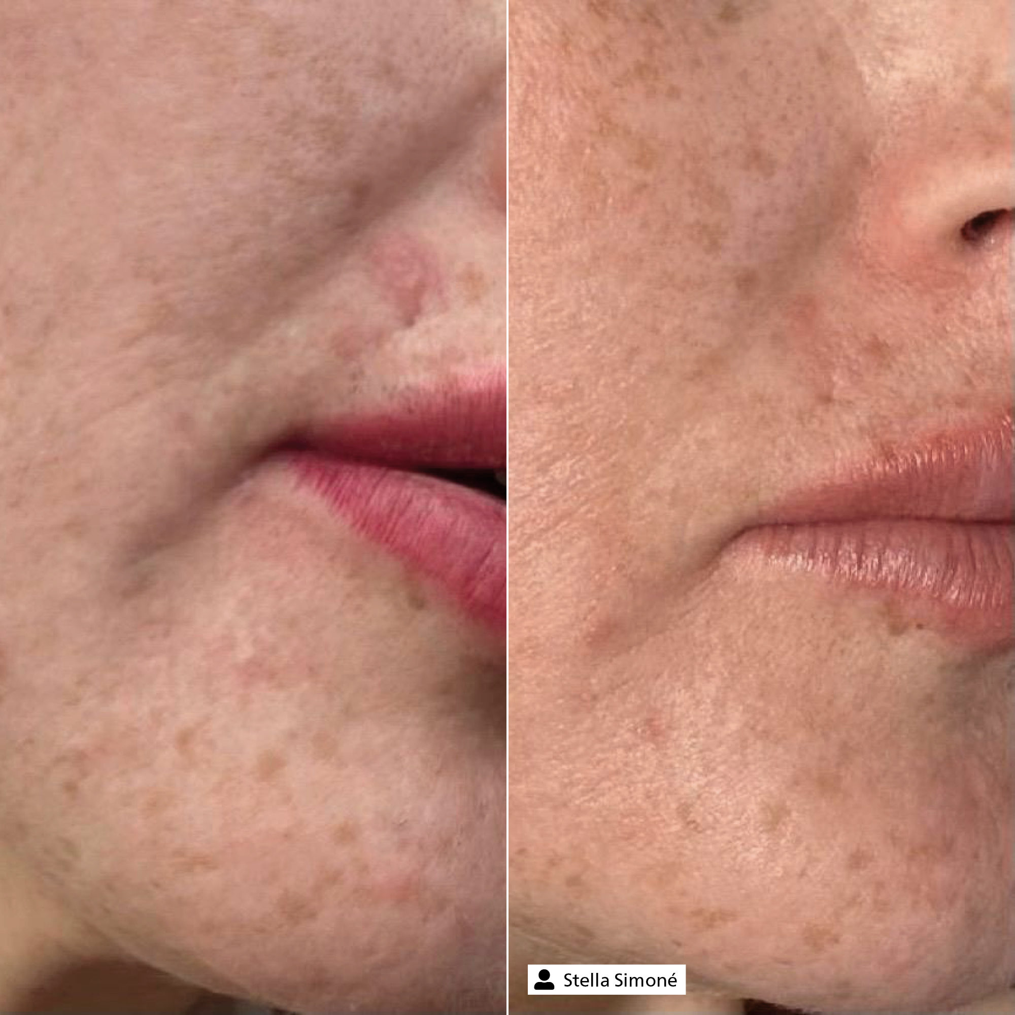 Balance Hydrating Cream Balance Hydrating Cream