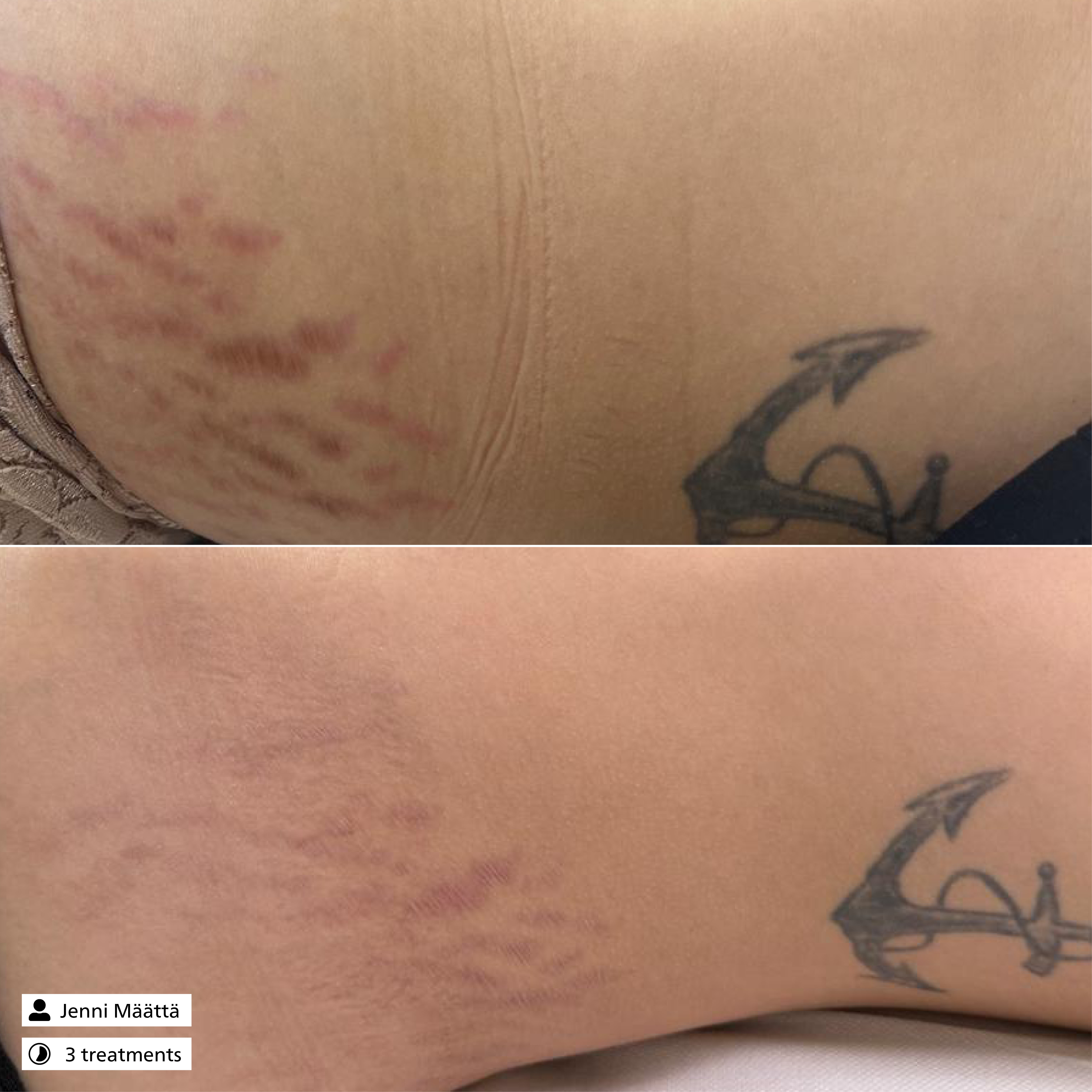 Tissue Firming Serum