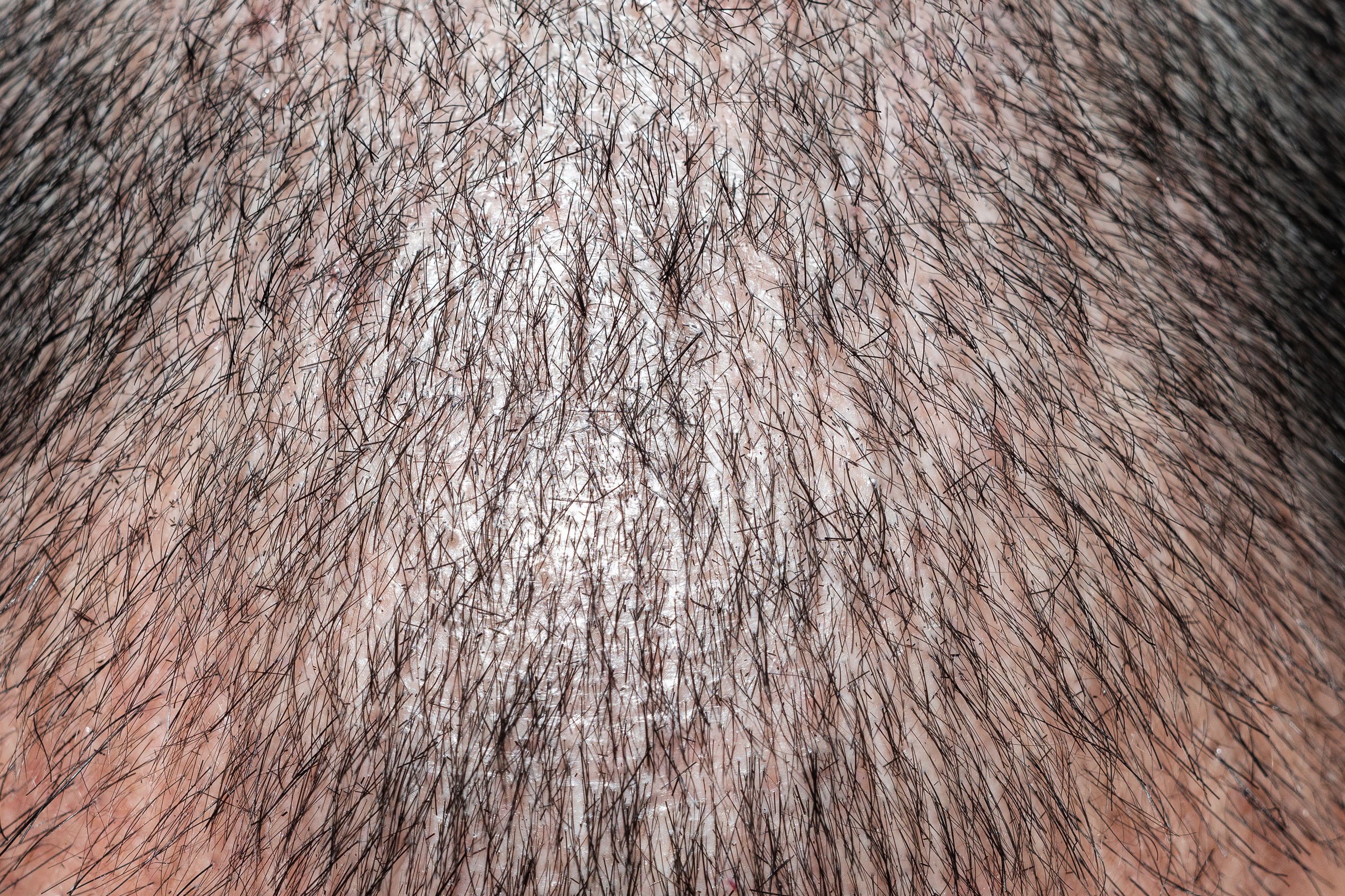 dsr_category_hair_vitality_2