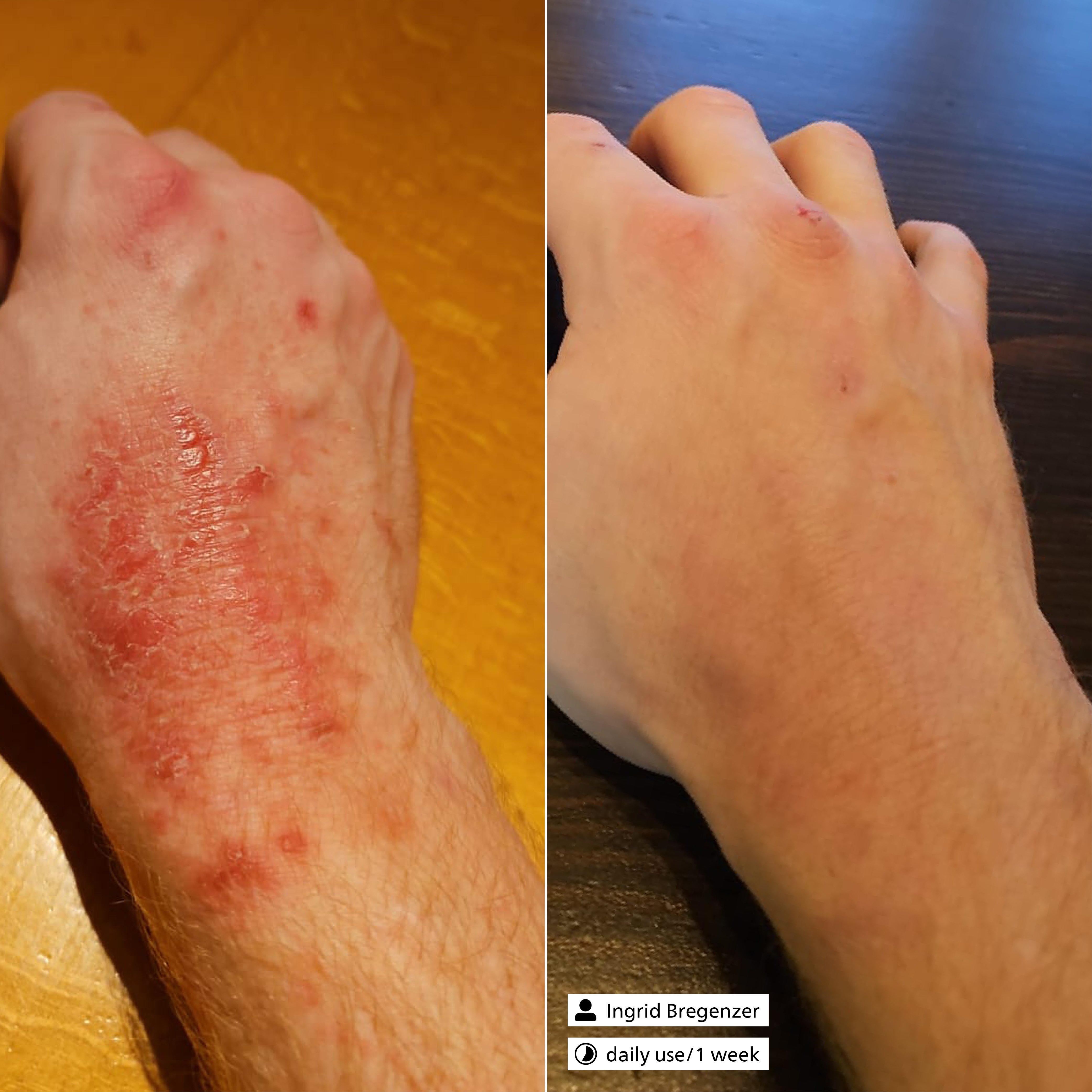 Active Exosome Serum