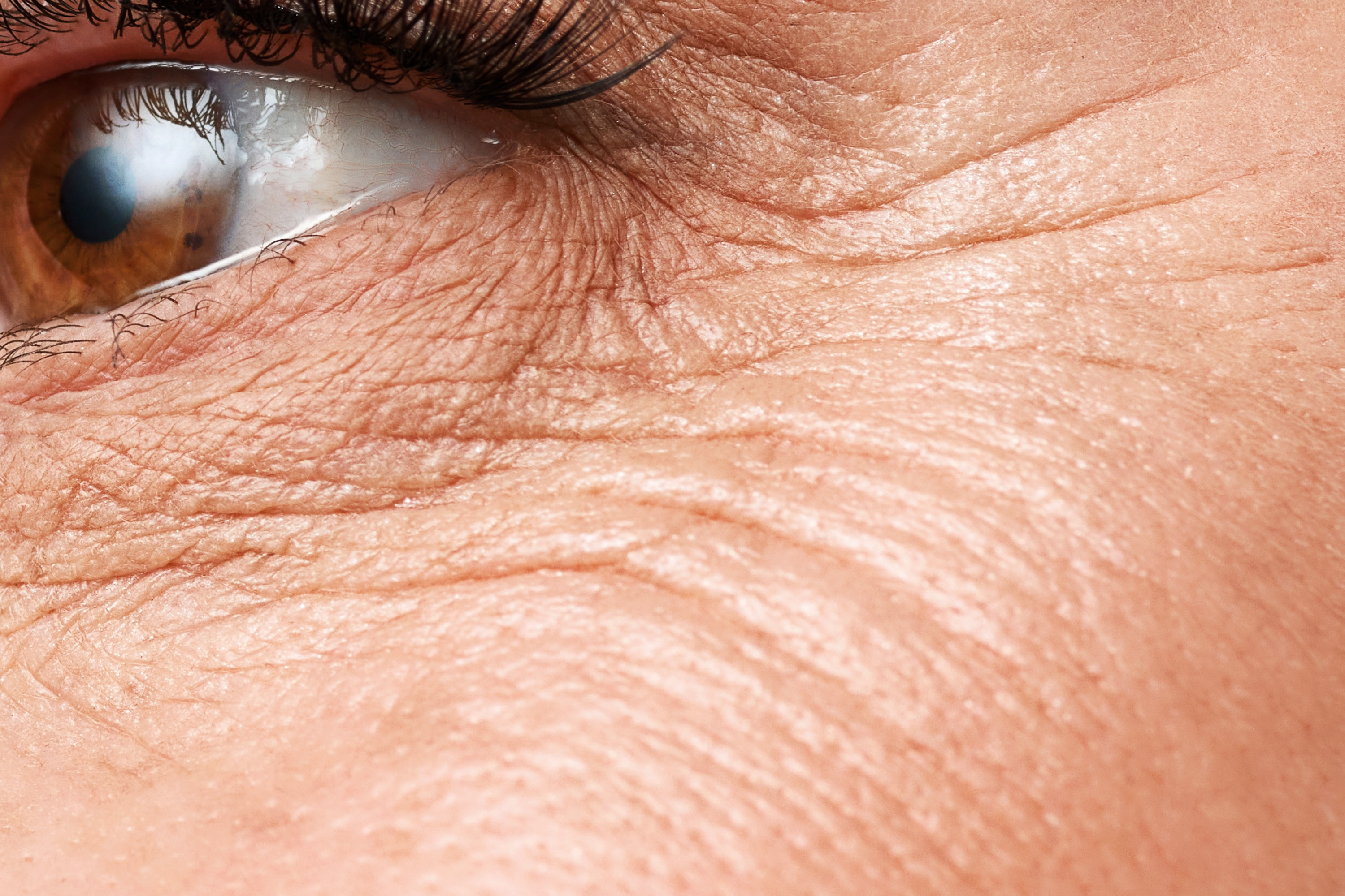 dsr_category_eye_area_2