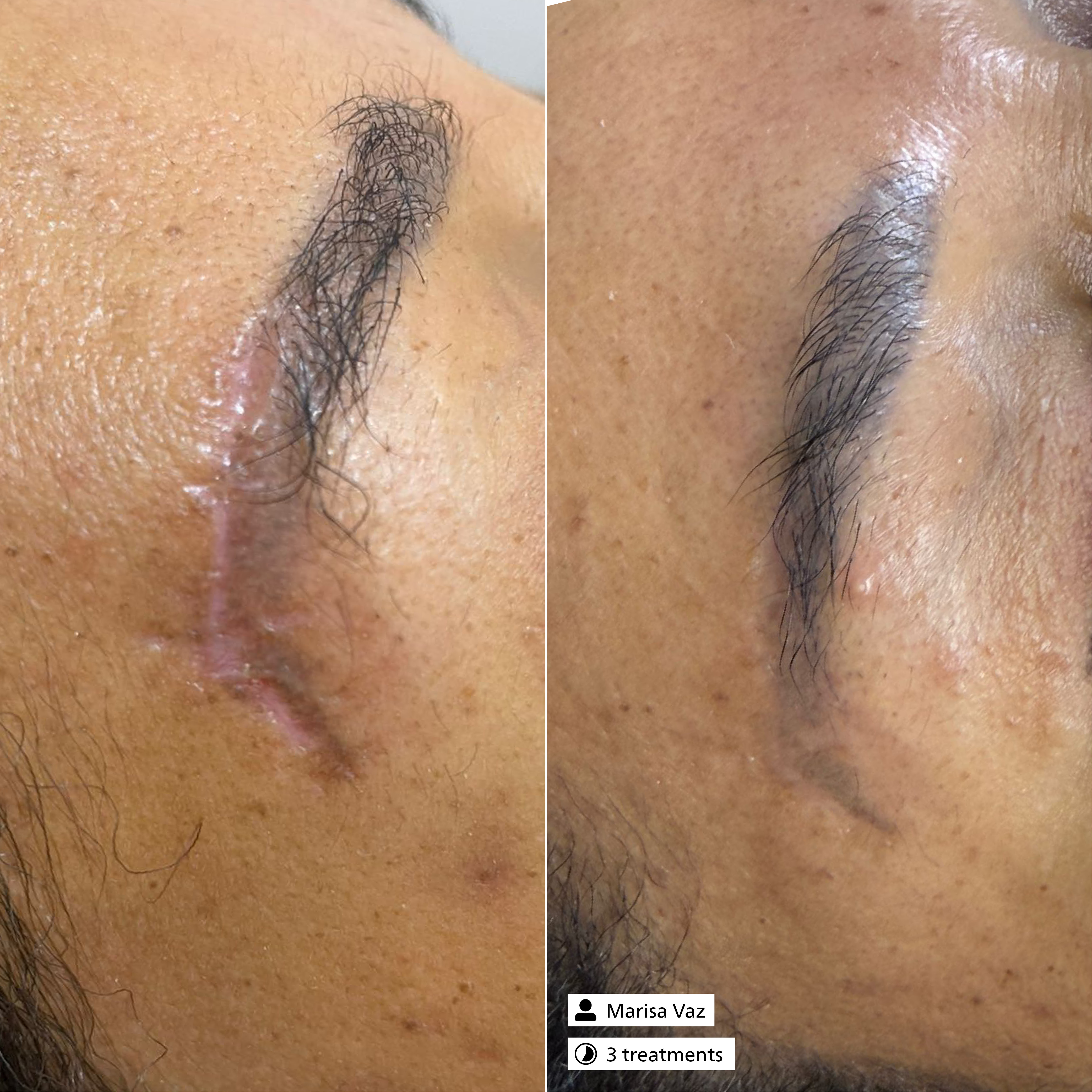 Active Exosome Serum