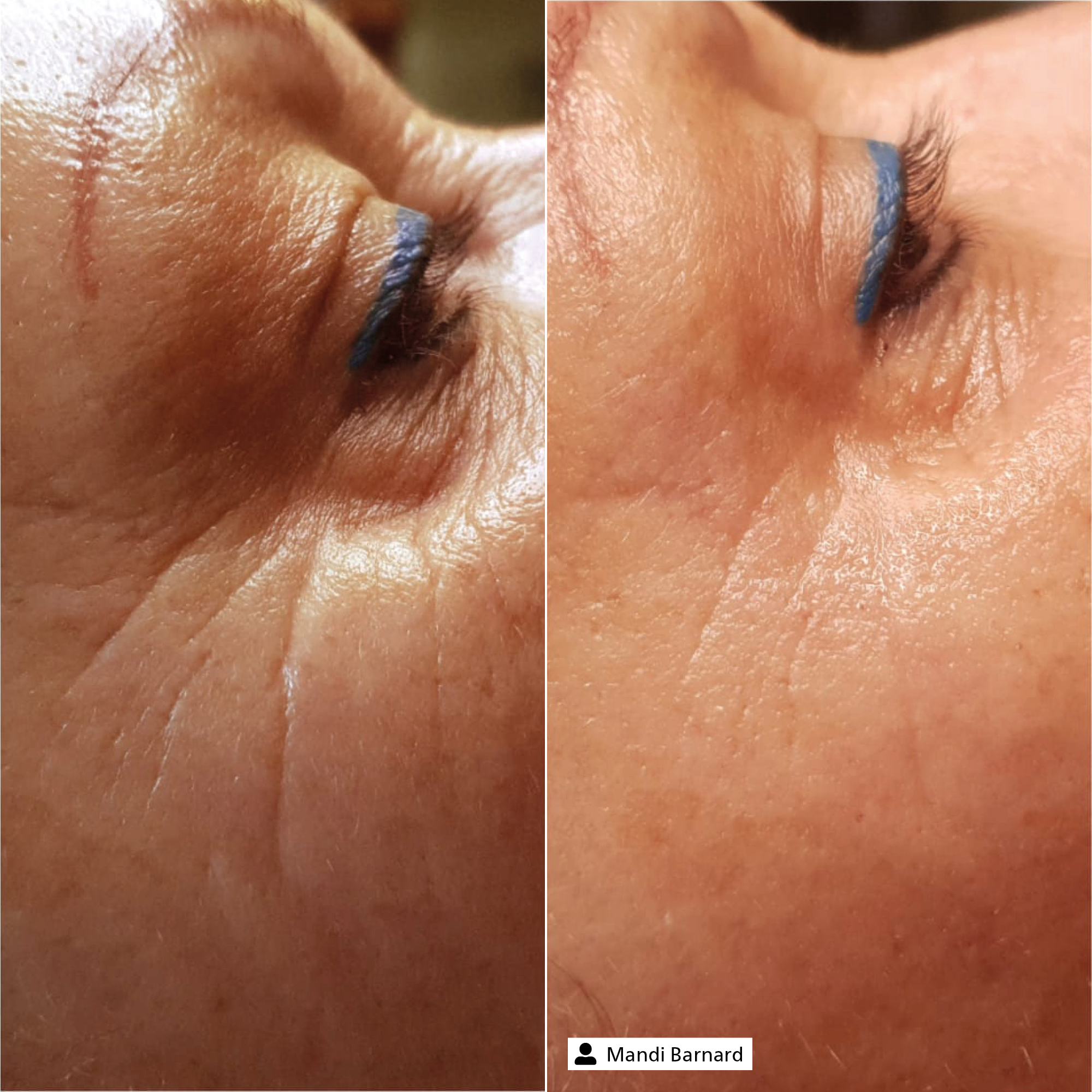 Eye Expert Serum Eye Expert Serum